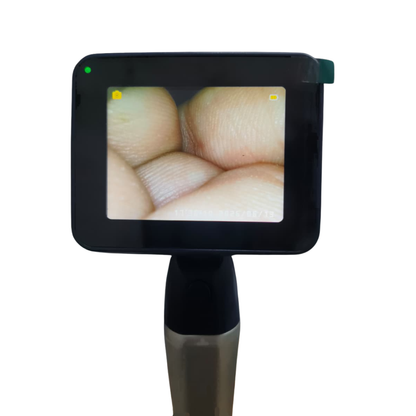 Video Laryngoscope Model- SCOPE-VA