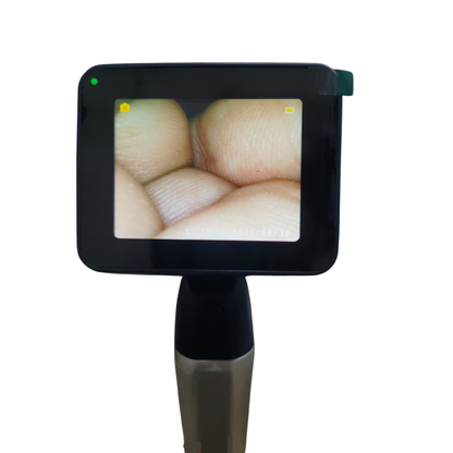 Video Laryngoscope Model- SCOPE-VP